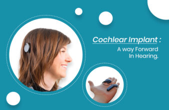 Cochlear Implant : A way Forward In Hearing. - Asha Speech and Hearing ...